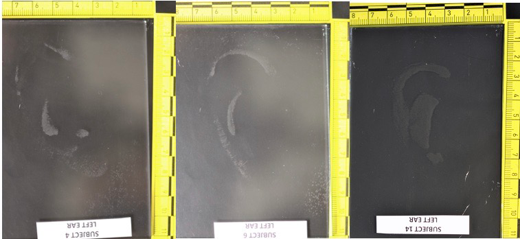 Figure 6: Examples of Ear Prints with the Least Visible Morphological and Metric Values.