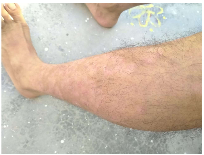 Figure 2: ** After treatment.