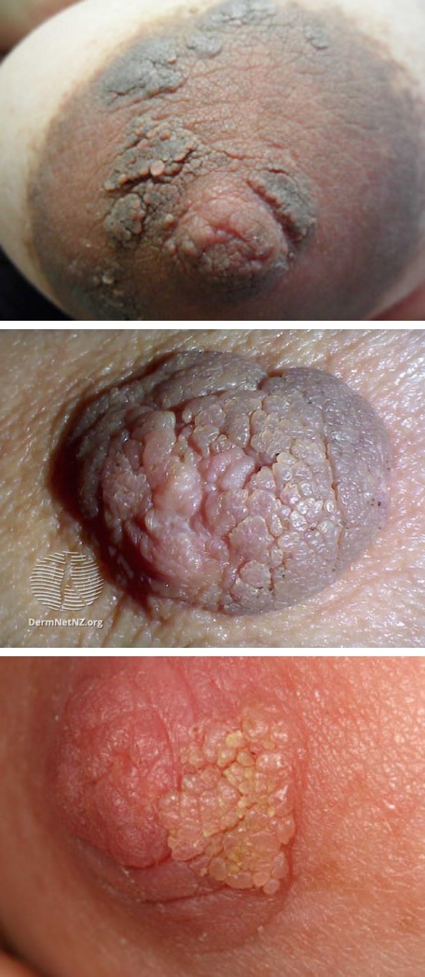 Figure 1: Causes of hyperkeratosis.