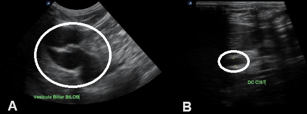 Figure 1: ** Abdominal ultrasound.