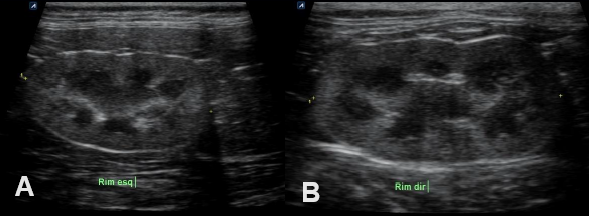 Figure 2: Abdominal ultrasound.