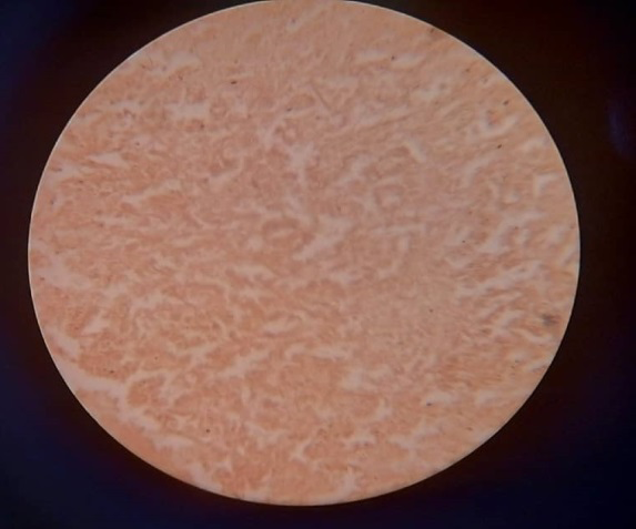 Figure 1: Liver tissue stained with black plum extract with potassium alum as mordant.
