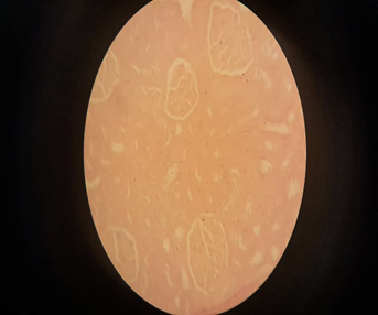 Figure 2: Kidney tissue stained with black plum extract with potassium alum as mordant.