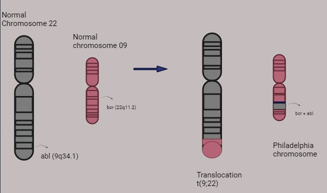 Figure 1: Shows the Chromosome 22 and 9 –wild and Philadelphia chromosome.