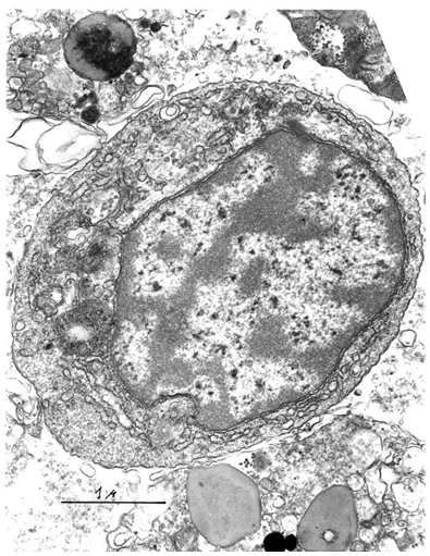 Figure 1: A sea star B lymphocyte.