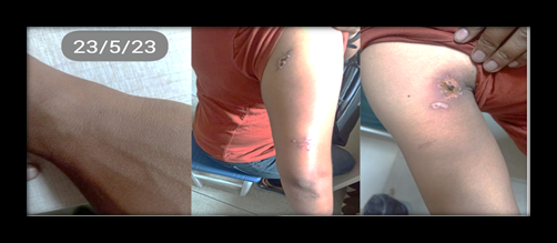 Figure 4: Follow up after a week.