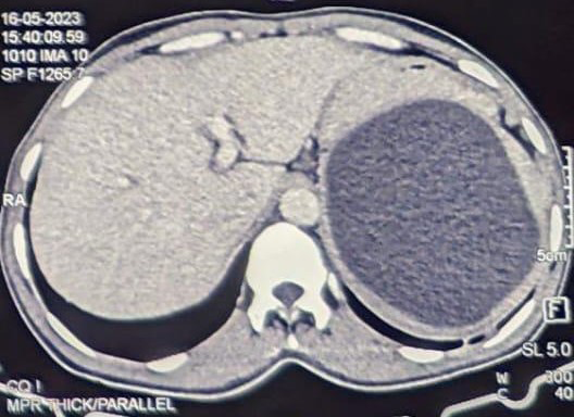 Figure 1: Photo of CT Scan.