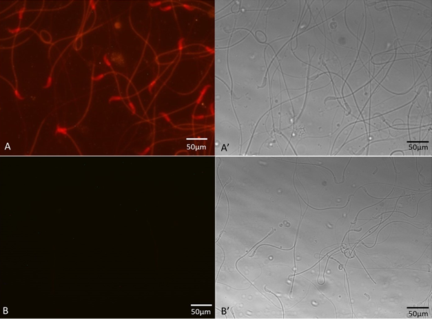 Figure 2: Fluorescence (A, B) and matched phase-contrast (A,’ B’) photomicrographs of cauda epididymal spermatozoa immunostained with anti- fibrinogen beta chain antibody (A) revealed intense staining to the equatorial segment of the sperm head and faint staining in the tail. Sperm stained with nonimmune serum showed no fluorescence (B). Bar = 50 µm.