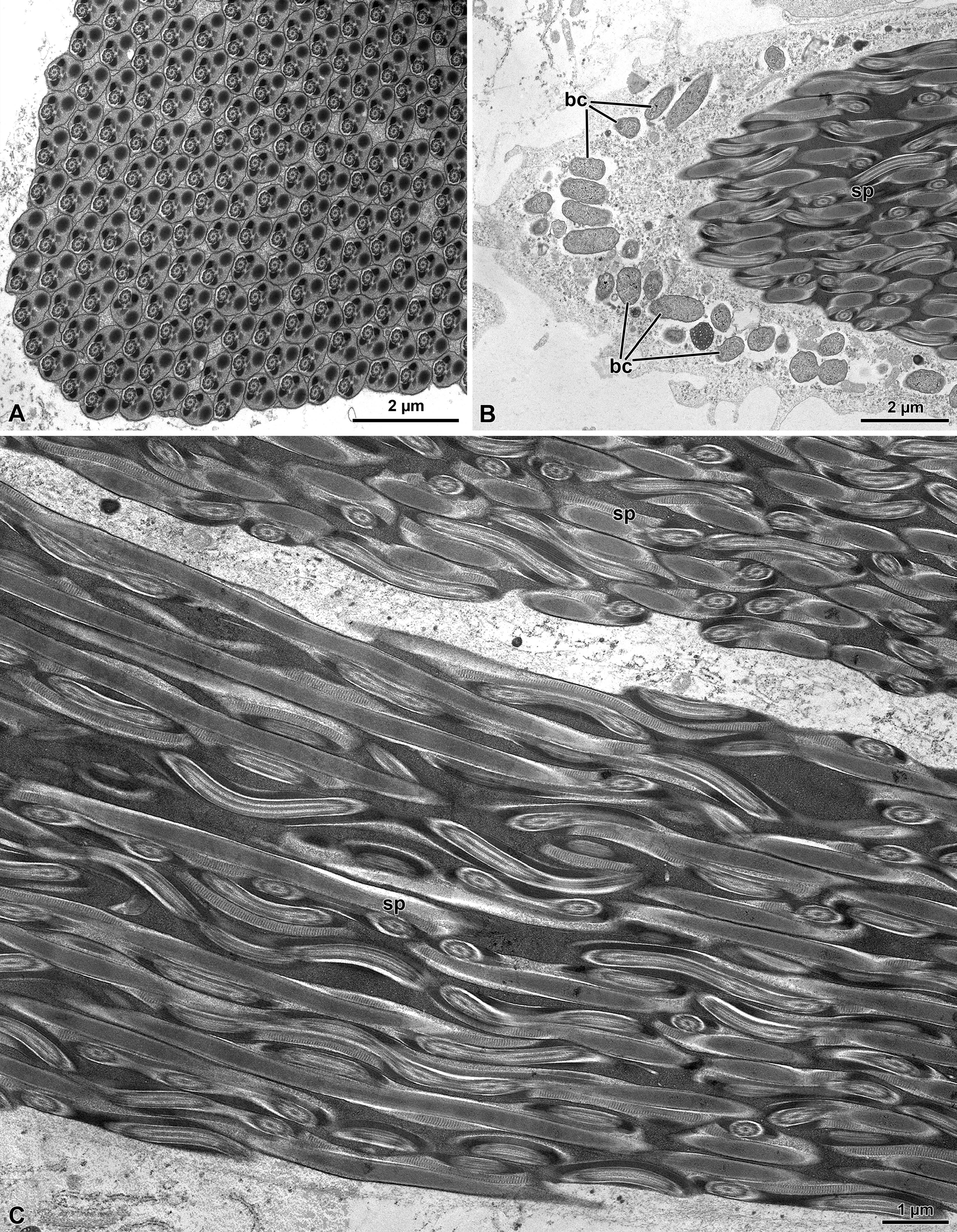 Figure 2: Meligethes flavimanus. A) Cross section through a sperm cyst of mature sperm (sp). B-C) Longitudinal section through a sperm cyst showing sperm flagella (sp) tightly and winding connected. Note that in the residual cytoplasm of the cyst cell several bacteria (bc) are visible.