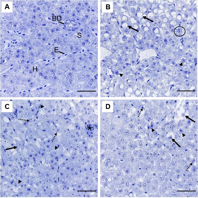 Figure 2: Representative histopathologies on liver of _Piaractus brachypomus_ exposed to Norton herbicide (2,4-D + Picloram) for 96 h. (A) Control. (B-D) liver of fish exposed to the herbicide. Alteration of hepatic architecture with nuclear alteration (arrow), hepatocytes atrophy (arrowhead) and nuclear hypertrophy (circle) can be observed on (B). Cellular degeneration (arrow), cytoplasmatic inclusions (dashed arrow) and vacuolization (arrowhead) can be observed on (C). Nuclear alteration (dashed arrow), hepatocyte atrophy (arrowhead) and cellular degeneration (arrow) can be observed on (D). BD = Biliary duct; E = erythrocyte; H = hepatocyte and S = sinusoids. Scale bar = 20 µm.