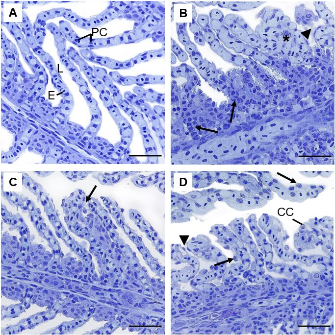 Figure 3: Representative histopathologies on gills of _Piaractus brachypomus_ exposed to Norton herbicide (2,4-D + Picloram) for 96 h. (A) Control. (B-D) gills of fish exposed to the herbicide. Pillar cells constriction (arrow), lamellar congestion (*) and epithelium rupture (arrowhead) can be observed on (B); hyperplasia (arrow) can be observed on (C); epithelium displacement (arrowhead) and cellular hypertrophy (arrows) can be observed on (D). E = erythrocyte; L= lamellae; PC = Pillar cells; CC = Chloride cells. Scale bar = 20 µm.