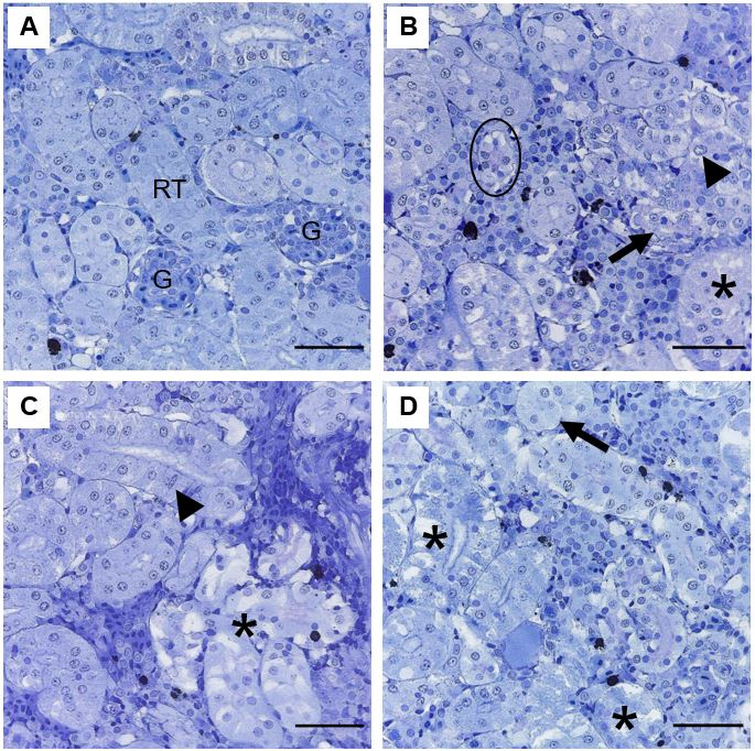Figure 4: Representative histopathologies on kidney of _Piaractus brachypomus_ exposed to Norton herbicide (2,4-D + Picloram) for 96 h. (A) Control. (B-D) Kidney of exposed fish. Nuclear alterations of tubular cell (arrowhead), tubule atrophy (circle), disarranged tubules (arrow); tubular degeneration (*) and tubule hypertrophy (dashed arrow) can be observed. G = glomerulus; RT = Renal tubules. Scale bar = 20 µm.