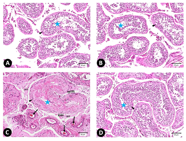 Figure 4: (A-D) photomicrograph of testis sections stained with H&E (X 400) (n = 10). (A) C group, (B) Sf-group, (C) MG- group, and (D) Sf+MG-group (Note: seminiferous tubules: star, spermatogenic cells: arrowhead, congested blood vessels: arrow, hyalinized interstitial tissue: hit, irregular and discontinuation of basement membrane: multiple arrow heads). (E) Histopathological soring. * Significant (p < 0.05) difference in comparison to C-group. # Significant (p < 0.05) difference in comparison to MG-group. Data are presented as mean ± SD, (n=10).