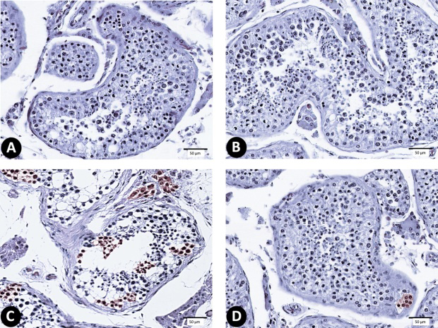 Figure 6: (A-D) photomicrograph of testis sections stained with anti-caspase-3 (X 1000) (n = 10). (A) C group, (B) Sf-group, (C) MG-group, and (D) Sf+MG-group.