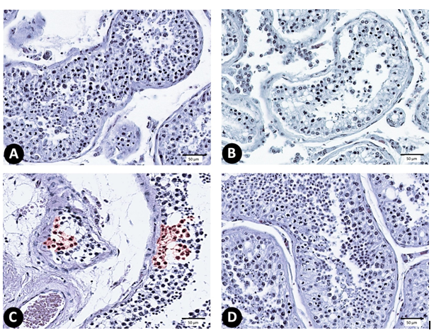Figure 7: (A-D) photomicrograph of testis sections stained with anti-glutathione reductase (X 1000) (n = 10). (A) C group, (B) Sf-group, (C) MG-group, and (D) Sf+MG-group.