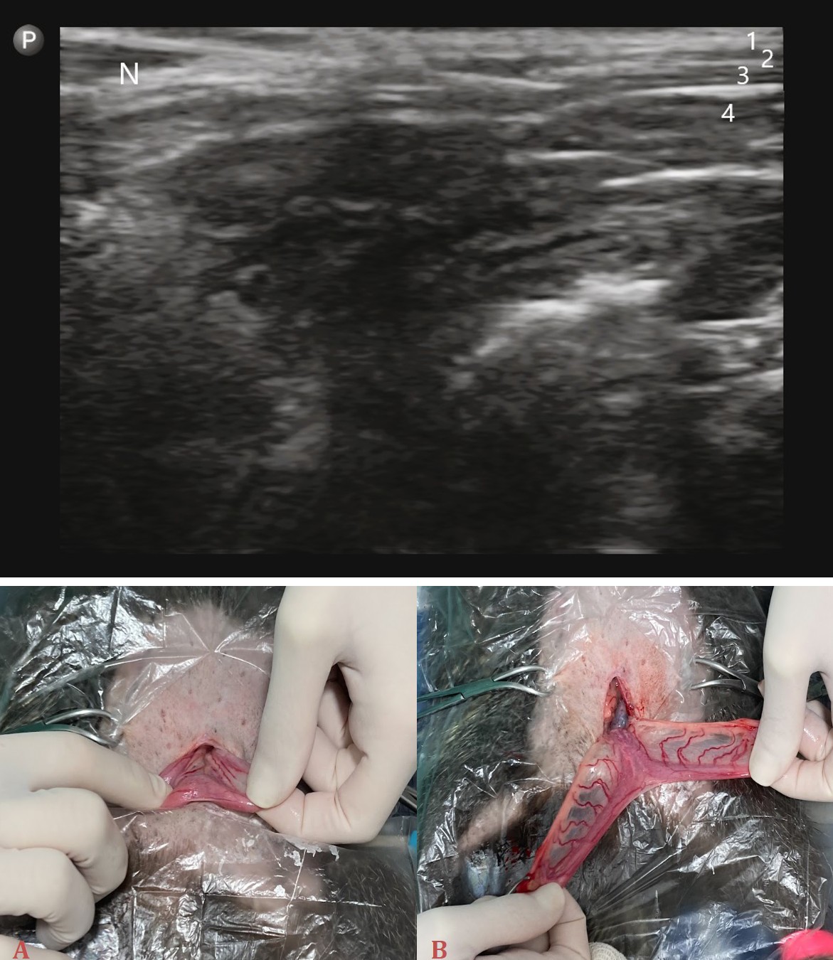 Figure 3: ** Ultrasound image of the TAP Block Antisepsis of the operative field was done with 70% ethanol alcohol and 0.2 % chlorhexidine digluconate solution. Ovariohysterectomy was performed through a retro- umbilical celiotomy, with an incision in the ventral midline of the abdomen of about 2 cm. The uterine cervix was palpated dorsal to the bladder and then exteriorized (Figure 4). The mesovarium is very short and exteriorization of ovaries was difficult, so the suspensory ligament was torn using digital pressure. Hemostasis was done with 3.0 polyglycolic acid ligatures around the vessels cranial to the ovaries bilaterally. The mesometrium was torn without damaging the local vessels. Finally the uterus was removed (Figure 5) by a transfixing ligature just cranial to the cervix with the same suture material. The musculature and subcutaneous tissue were closed in a continuous simple pattern with polyglycolic acid 3.0. Intradermal pattern was used for skin closure, so there was no suture material exposed, preventing the animal from chewing the sutures.