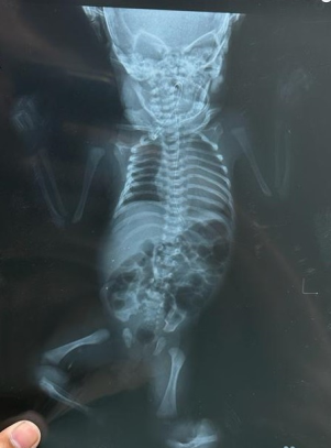 Figure 6: Normal Infantogram.