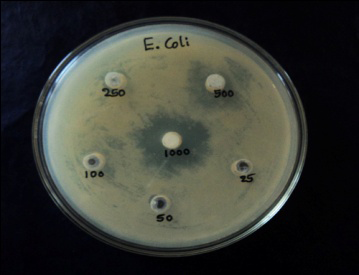 Figure 1: Antibacterial activity of plant extracts.
