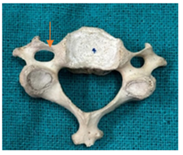 Figure 2: The elliptical shape.