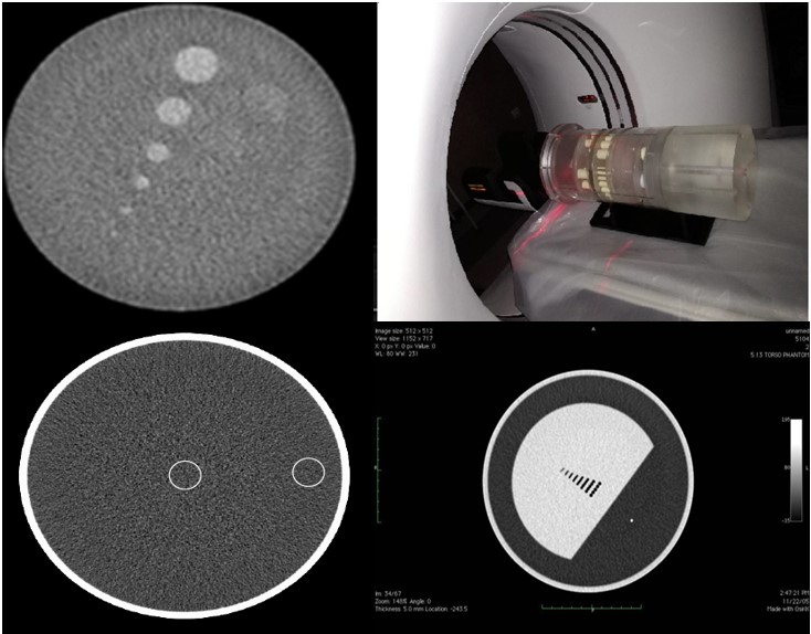 Figure 1: MDCT scanner and BMMD 7-phantom.