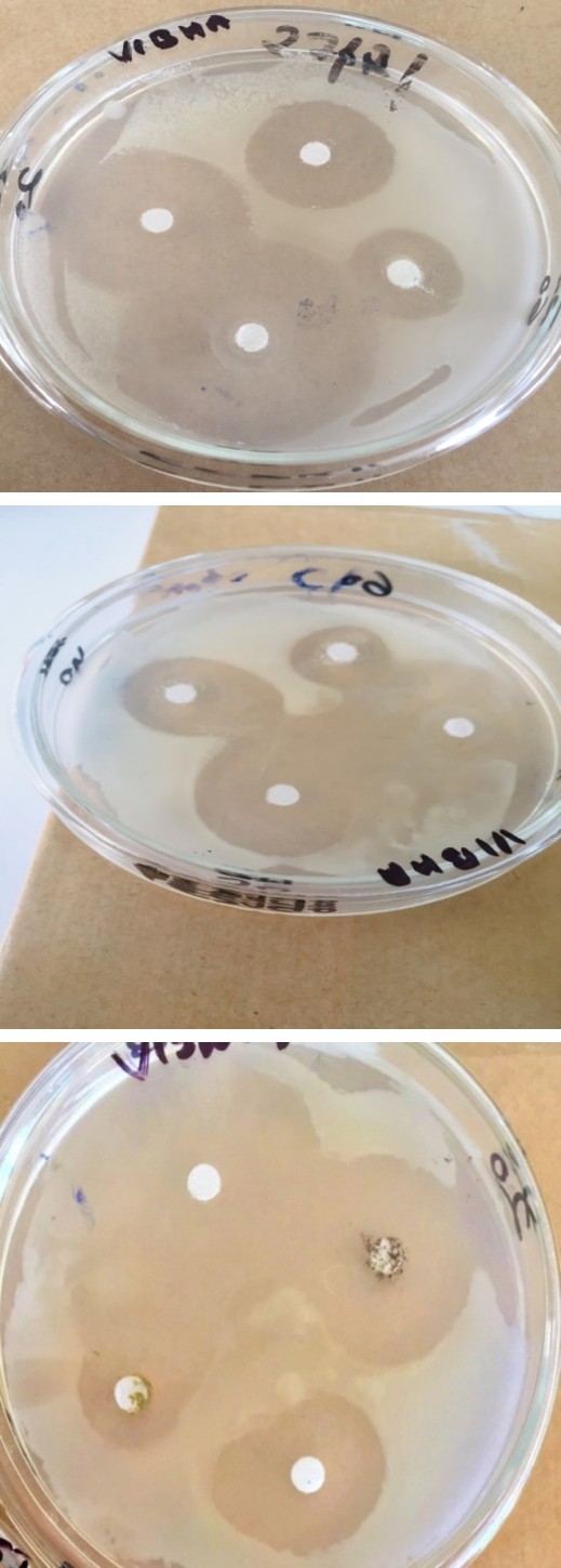 Figure 7: Results of ZOI of the bacterias. 1. Escherichia coli, 2. Pseudomonas aeruginosa, and 3. Bacillus subtilis.