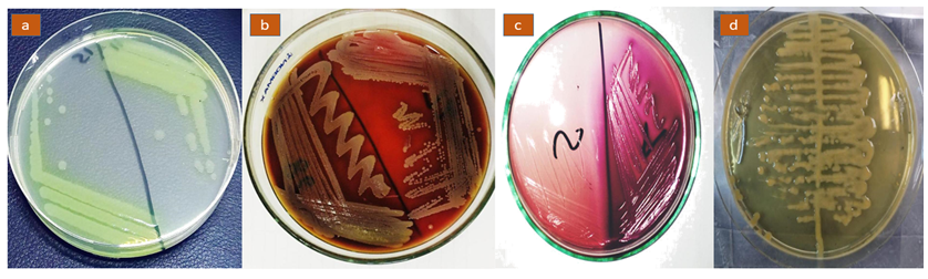 Figure 1: The isolates were observed under microscope 100 X has been presented in Figure 2.