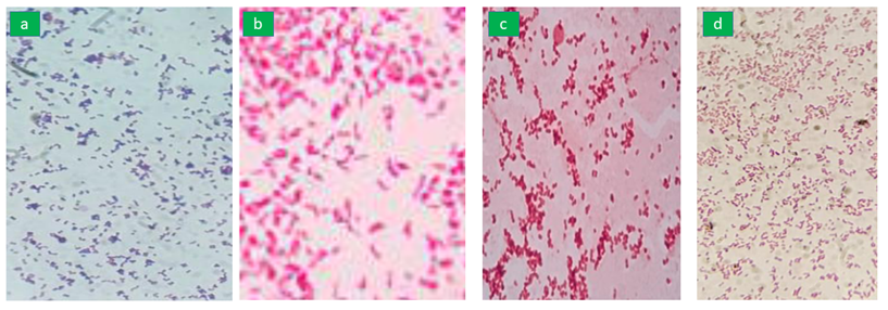 Figure 2: Presenting microscopy of (a) S. aureus, (b) E. coli, (c) K. pneumonia, (d) P. aeruginosa observed at 100x.