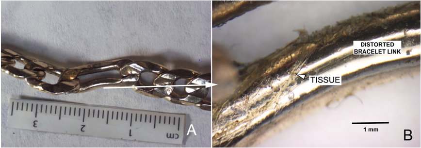 Figure 14: A. The bracelet part showing the distorted link. B. an enlargement of the link shows dried tissue on the link which likely came from the wound on Harris’ wrist. Images taken at Meixa Tech.