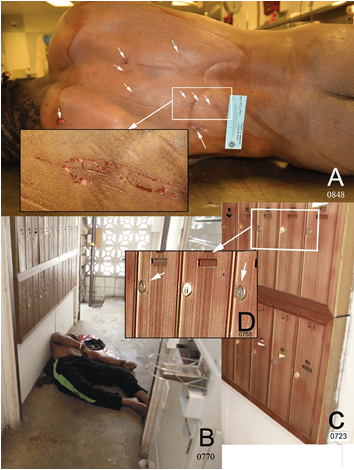 Figure 3: A. Images of the abrasions on the victim’s back (at arrows) and described in the autopsy report ([1] p 186) that appear to have been caused by the victim being hard-pressed against the mailboxes. Inset: enlargement of indicated area on the victim’s back showing three vertical shallow abrasions to the body that occurred premortem. B. Shooting scene looking west showing the mailboxes on the south wall; the lock faces project which could have been the source of the abrasions and scratches on the unclothed back of the victim. C. The bank of mailboxes. D. An image of the mailboxes face showing the lock mechanisms project from the surfaces of the mailboxes; two of the lock projections (arrows) for mailboxes 11 and 13 (top row) appears to have blood on their upper surfaces (arrows).