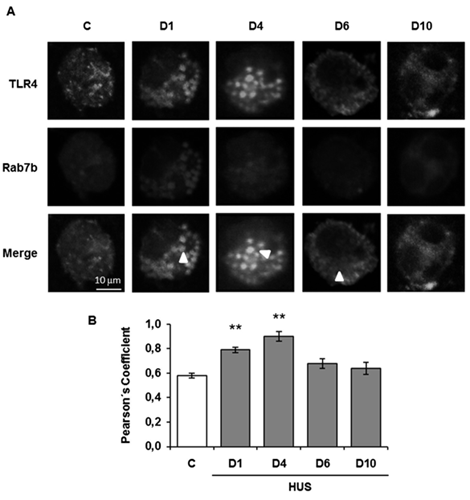 Figure 2: Colocalization analysis of Rab7b and TLR4 in monocytes during the acute course of HUS.