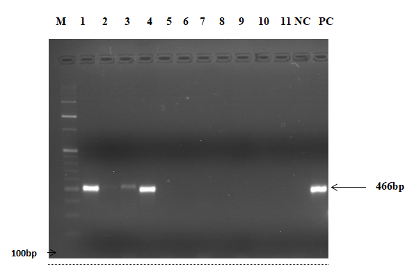 Figure 2: The Detection of IBV by RT-PCR. Key: Lane M: molecular ladder started at 100bp, Lane 1, 3, 4 positive samples around 466bp, Lane 2 and 5-11 Negative Samples, Lane NC – Negative Control, Lane PC –Positive Control around 466bp.