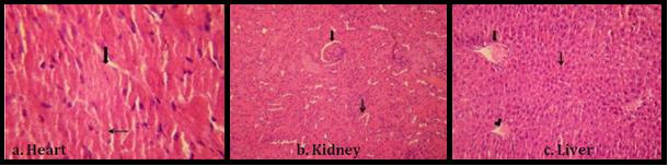 Figure 7: Transverse section of hepatic tissue of rats (a) Normal control group showing normal architecture; (b) high fat diet (HFD) group; (c) HFD + Simvastatin (10 mg/kg) group;(d) HFD + mycoprotein (100 mg/kg) group; (e) HFD+ mycoprotein (200 mg/kg) group; (f) HFD+ mycoprotein (400 mg/kg) group.
