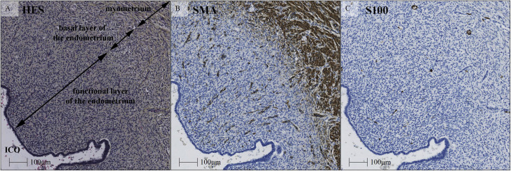 Figure 3: Courtesy ref no-9-Structure and innervation of the endometrium.