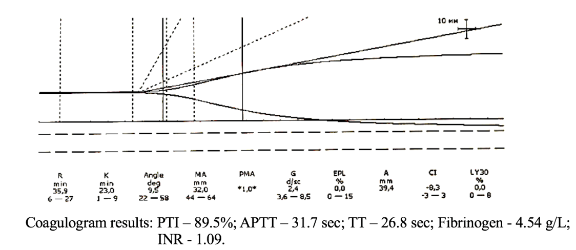 Figure 6: In Figure 6, the coagulogram data only indicate a risk of hypocoagulation. At the same time, the thromboelastogram (TEG) shows pronounced hypocoagulation that requires immediate correction.
