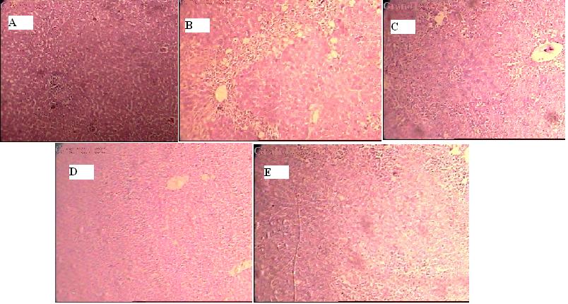 Figure 1: Liver tissue of control groups (A) showing normal hepatocytes, sinusoidal spaces, and central vein. Carbon tetrachloride treated (B) liver tissues showing intense centrilobular necrosis, vacuolization and macrovesicular fatty changes, sinusoidal congestion, Srividya L, et al. Hepatoprotective Activity of Hydroalcoholic Extract of Murraya Koeinigii Leaves against CCl4-Induced Hepatotoxicity in Rats. Adv Clin Toxicol 2017, 2(1): 000118.