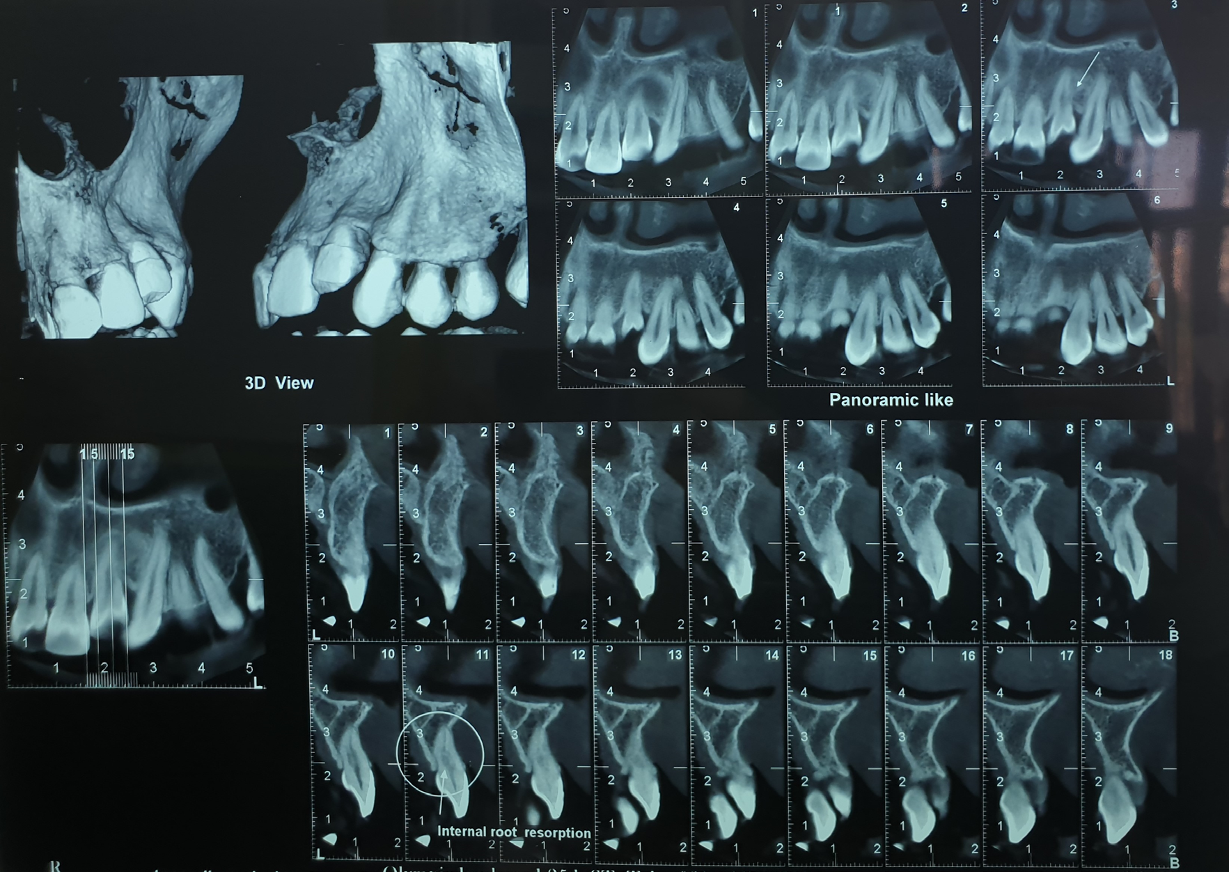Figure 1: Pretreatment CBCT.