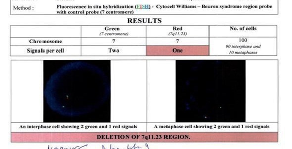 Figure 2: Fish Test of the Neonate.