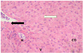 Figure 10: Liver of Clarias gariepinus juveniles exposed to 0.15 mg/l of DD-Force.