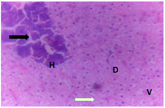 Figure 13: Liver of Clarias gariepinus juveniles exposed to 0.30 mg/l of DD-Force.