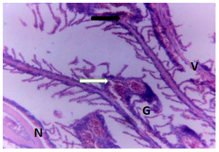 Figure 5: Gills of Clarias gariepinus exposed to 0.20 mg/l of DD-force.