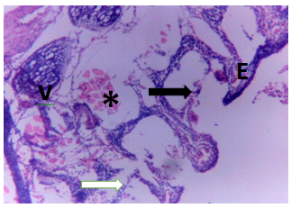 Figure 6: Gills of Clarias gariepinus exposed to 0.25 mg/l of DD-force.
