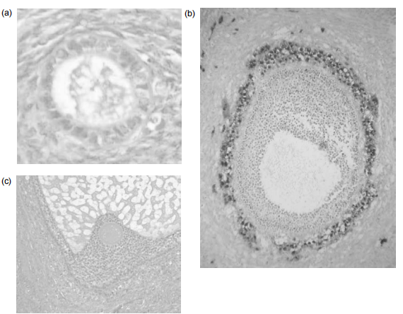 Figure 1: The development of a follicle, from (a) primordial, (b) small antral and (c) pre-ovulatory stages. (a)	 The primordial follicle is surrounded by a single layer of undifferentiated epithelial cells and is insensitive to gonadotropins. (b)	 The early antral follicle has well-differentiated theca (immunostained brown) and granulosa cell layers surrounding the developing antral cavity with the oocyte. (c)	 The pre-ovular follicle with the oocyte surrounded by the cumulus oophorus with well-differentiated granulosa and theca cell layers.