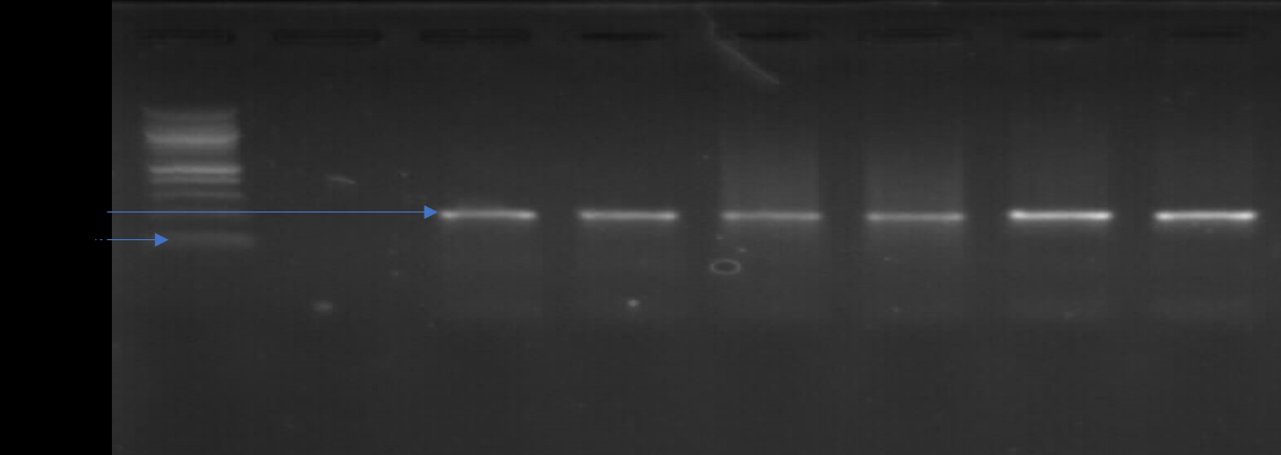 Figure 1: Gel representing tetracycline resistant gene (tetA) amplified.