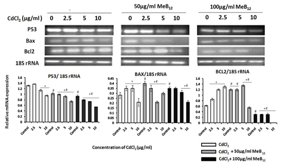 Figure 4: mRNA expression profile of metallothionein genes: a: control, b: 2.5µg/ml CdCl2, c: 5.0 µg/ml CdCl2, d: 10 µg/ml CdCl2.