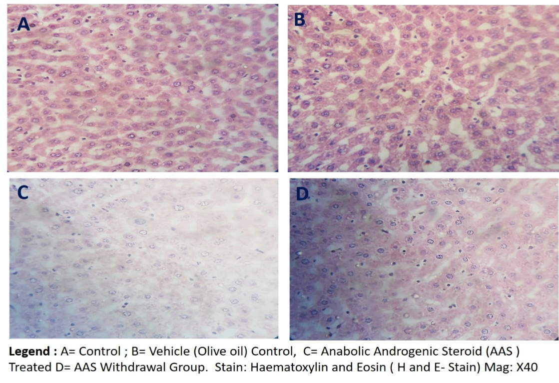 Figure 6: Representative photomicrograph of the H&E-stained hepatic tissue sections of the experimental Wistar rats of study, showing normal histological pictures in the vehicle control (A) and olive oil-treated (B) rats as compared with the AAS treated (C) rats. Legend: A=Control, B=Olive Oil Control, B= 120mg/kg b.w.t/ daily AAS for 21days and D= the 7days withdrawal groups following 21 days of 120mg/kg AAS treatment. Magnification x400, Scale bar 20 microns (20µm).