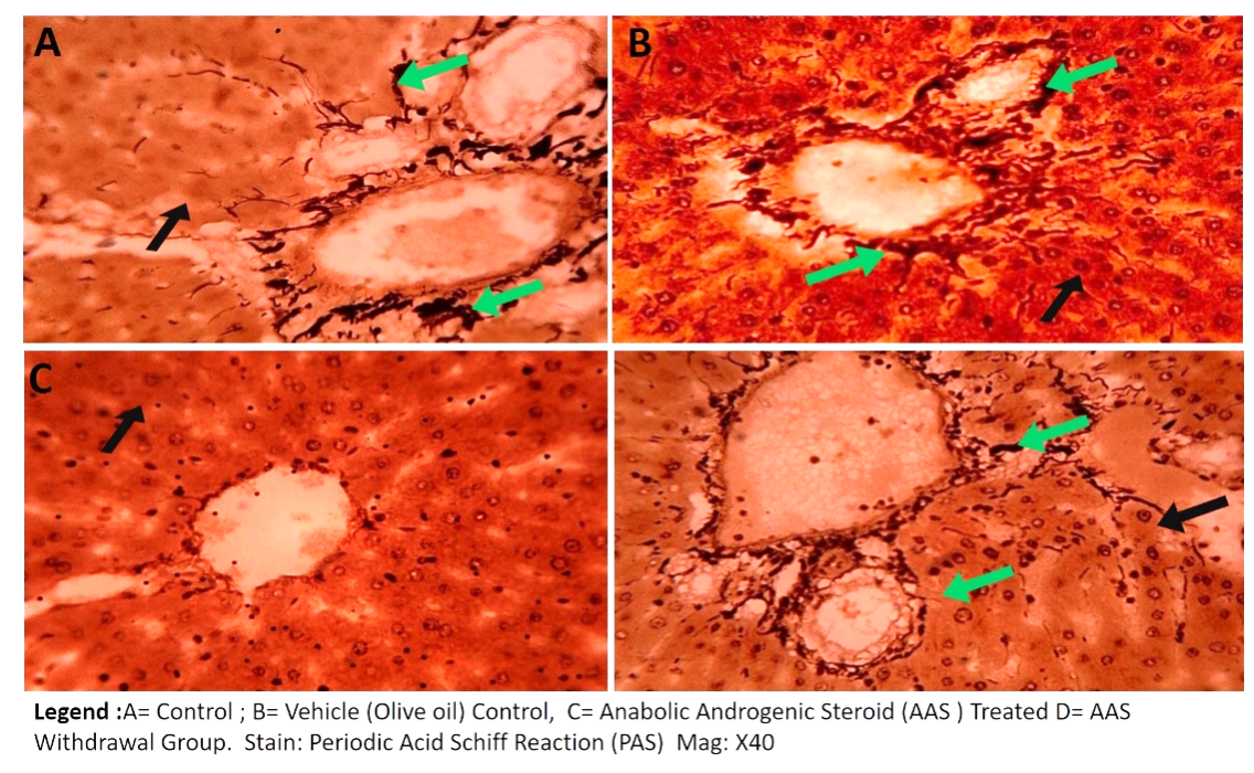 Figure 8: Representative photomicrograph of the histochemical stain for reticulin fibers in the hepatic tissue sections of the experimental Wistar rats of study, showing normal histological pictures in control, the vehicle control (A) and olive oil-treated (B) rats as compared with the AAS treated (C) rats. Legend: A=Control, B=Olive Oil Control, B= 120mg/kg b.w.t/ daily AAS for 21days and D= the 7days withdrawal groups following 21 days of 120mg/kg AAS treatment. Green arrows: reticulin fibers, black arrow= hepatocytes/ hepatic plates Magnification x400, Scale bar 20 microns (20µm).