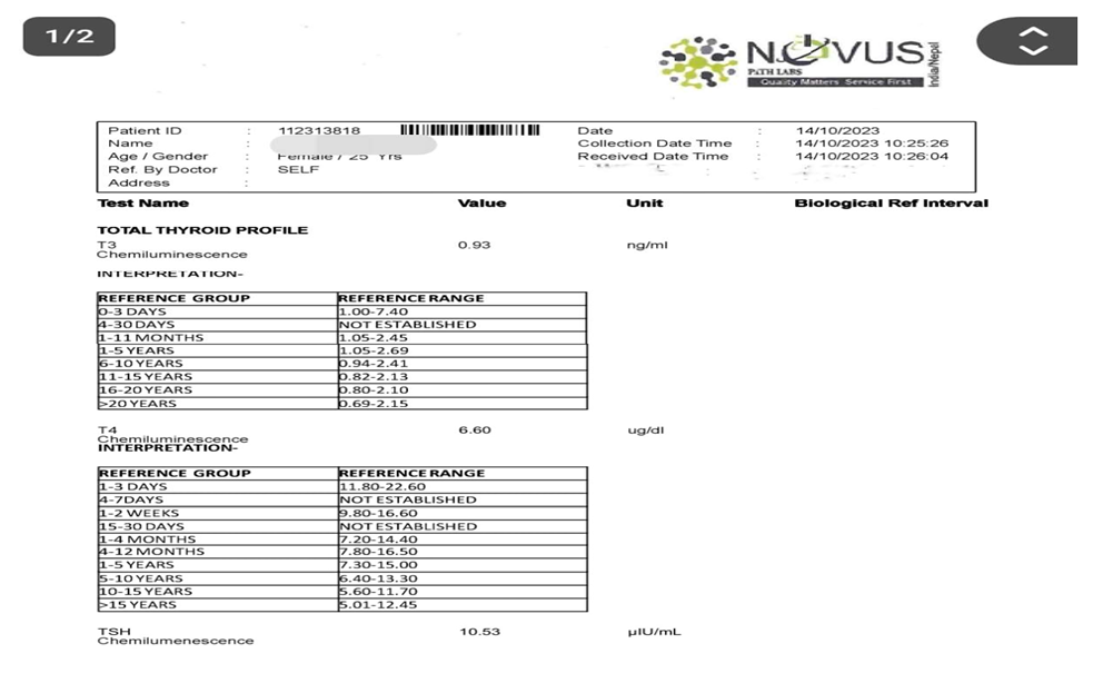 Figure 1: Before Test.