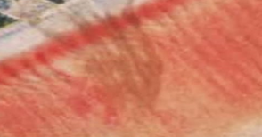 Figure 10: Lemaeosis.