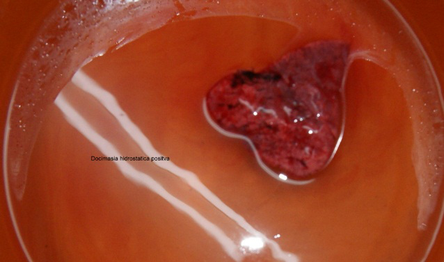 Figure 4: Hydrostatic Pulmonary Docimasia, Note that the Lungs Float in the Water, Signs of Pulmonary Oxygenation.