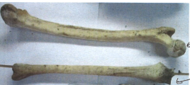 Figure 3: Skull with Teeth Found from Burial Site of Suspected Person’s Garden (Case Study-2).